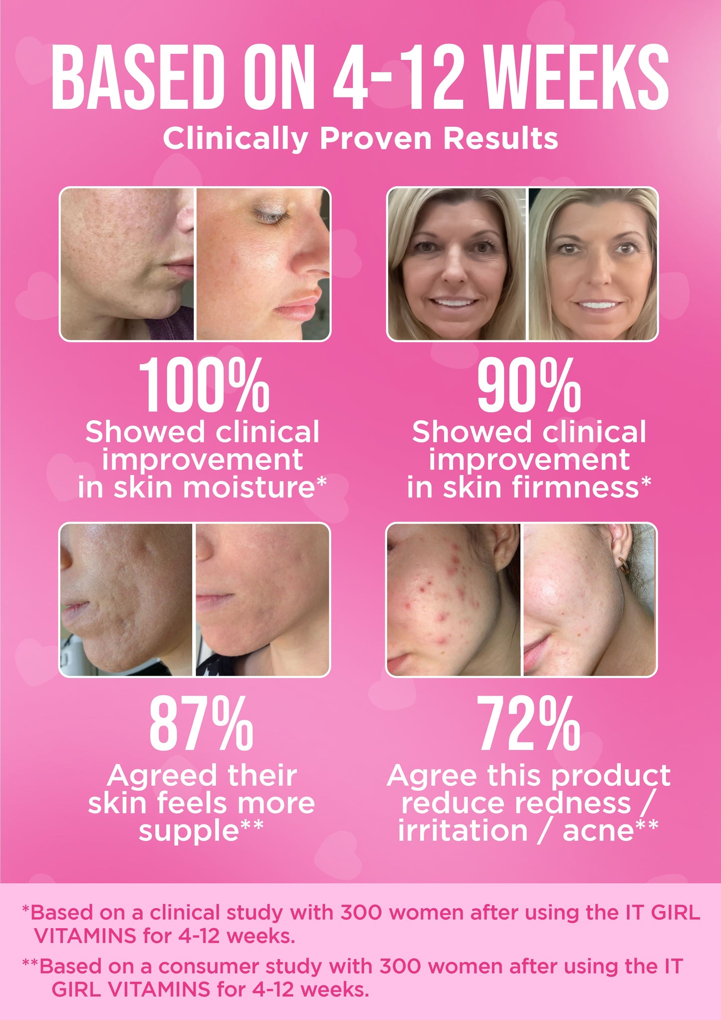It Girl Skin – Skin Food