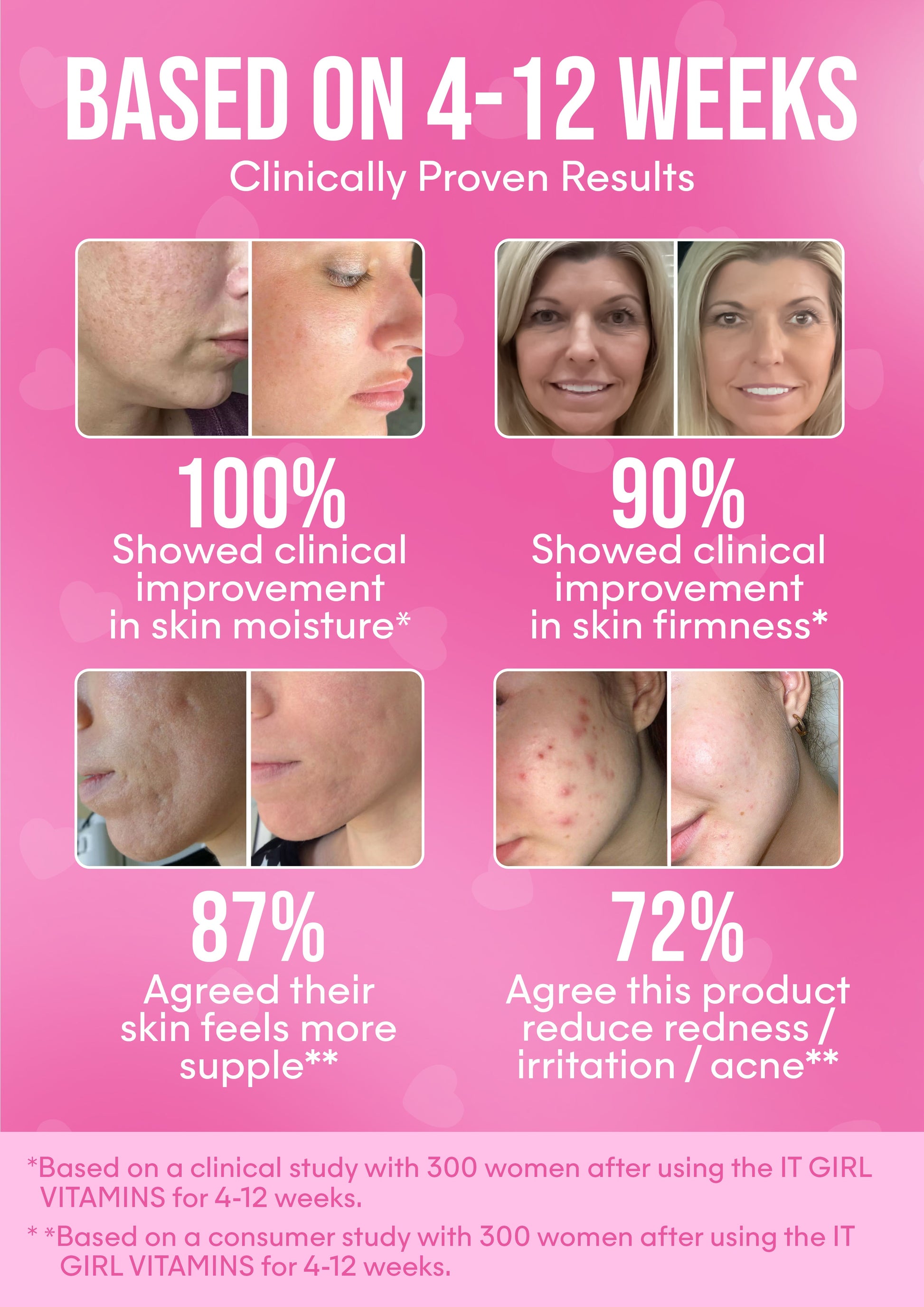 It Girl Skin – Skin Food - Triathlete Store