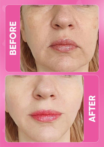 It Girl Skin | Collagen & Beauty Supplements for Flawless Skin
