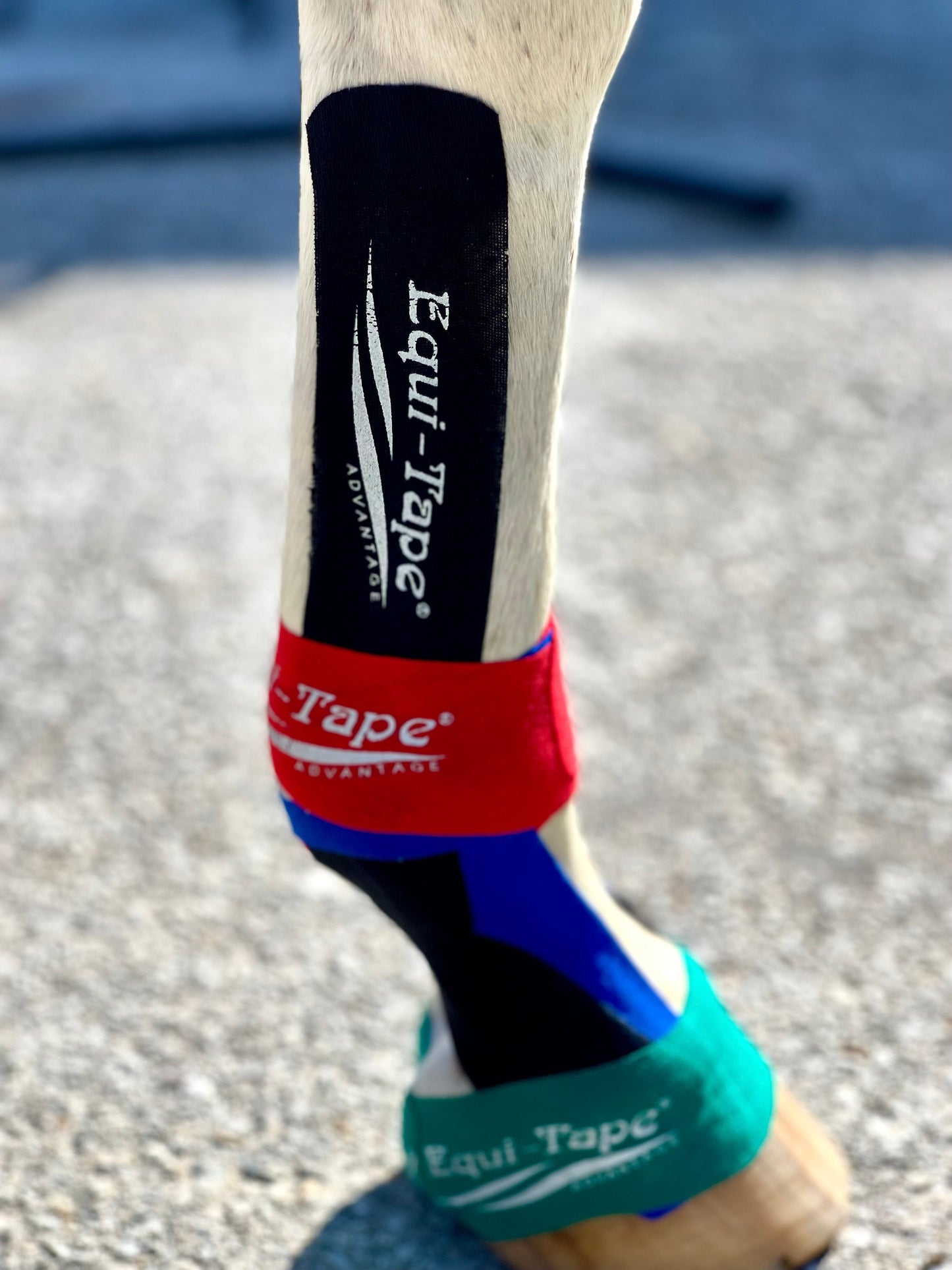 Module: Lower Leg