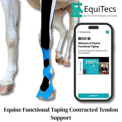 EFT Contracted Tendon Support