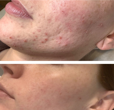 It Girl Skin – Skin Food - Triathlete Store